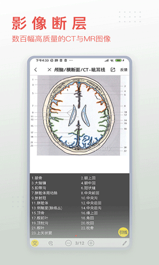 3dbody解剖app