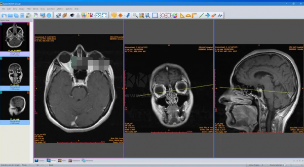 Sante DICOM Viewer Pro(医学DICOM图像浏览器)