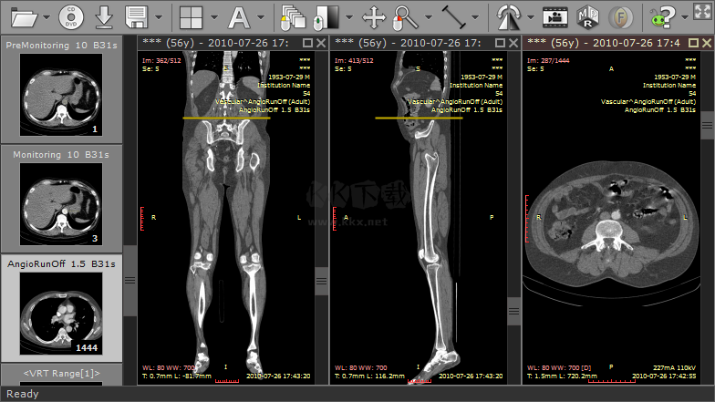 Sante DICOM Viewer Pro(医学DICOM图像浏览器)