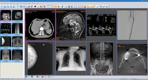 Sante DICOM Viewer Pro(医学DICOM图像浏览器)